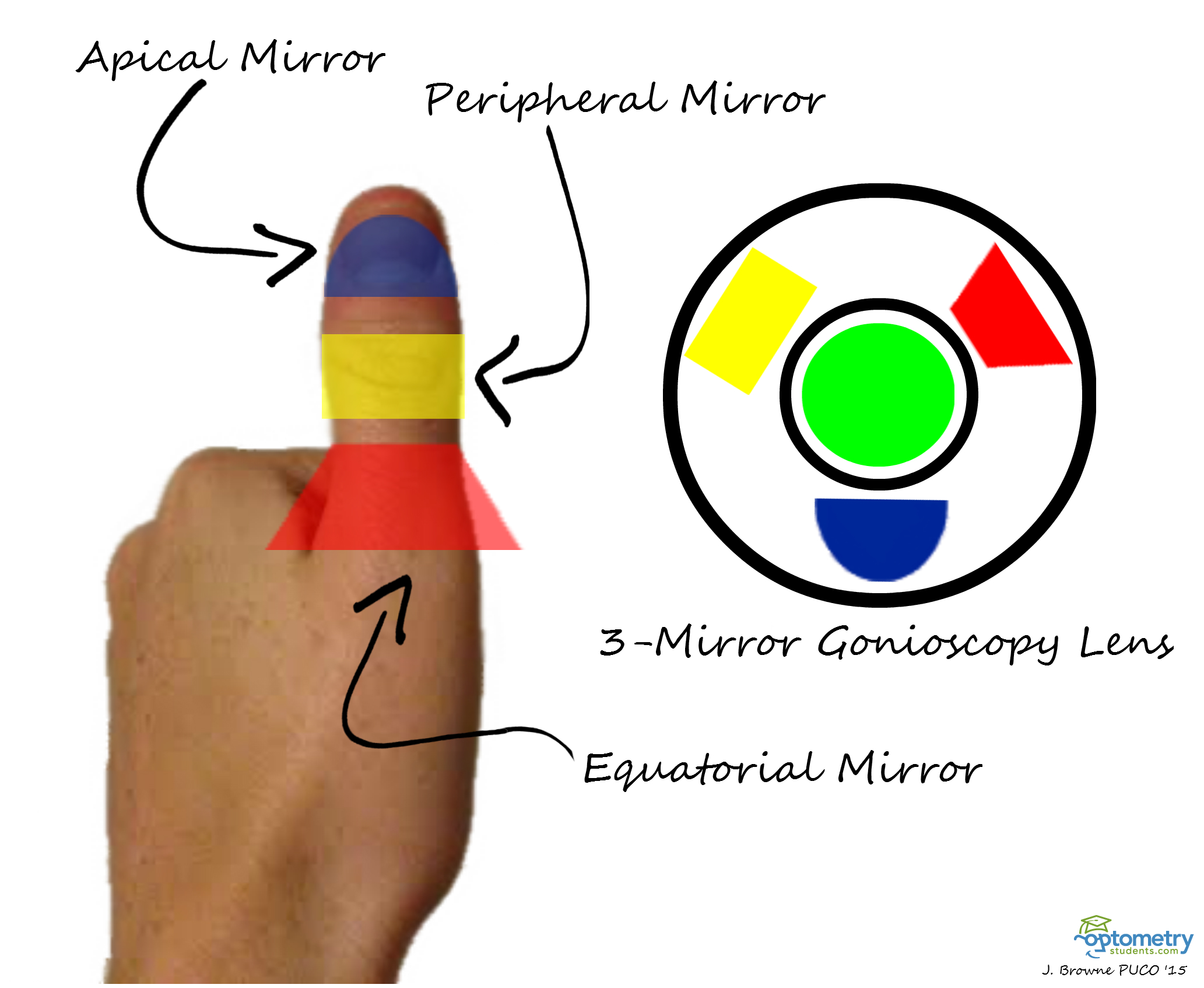bonen Tarief Entertainment Choose the Correct Gonioscopy Mirror Using Your Thumb!